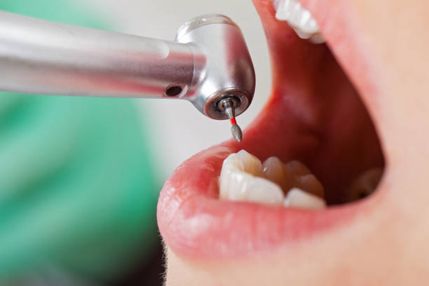 Best Urgent Dental Care for Toothache in Shannondale, WV